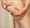 Pourquoi ne peut on pas se débarasser de la cellulite ?