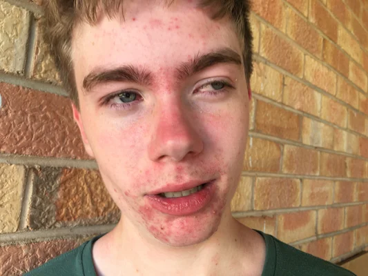 Image by JonahColinThorpe