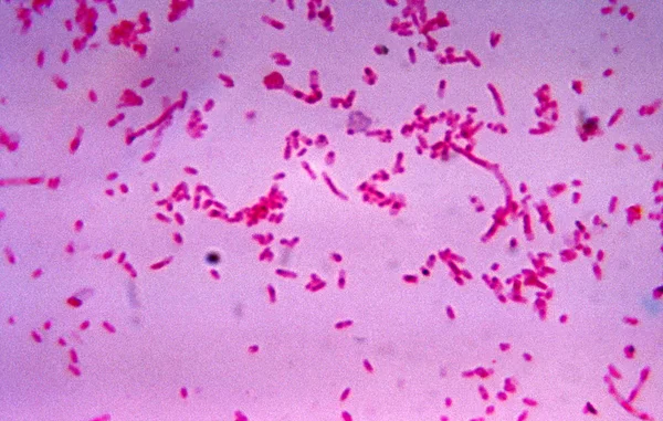 Vue microscopique de bactéries Fusobacterium sur fond violet