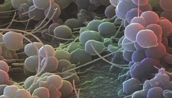 Détail microscopique de cellules bactériennes agrégées.