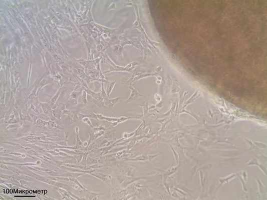 Culture cellulaire d'explants de cordon ombilical montrant des cellules souches mésenchymateuses au microscope.