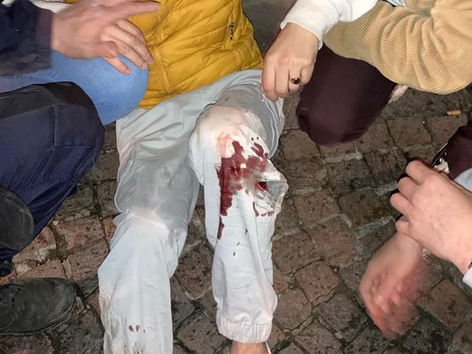 Blessure sanglante au genou d'une personne en gilet jaune après une morsure de chien policier.