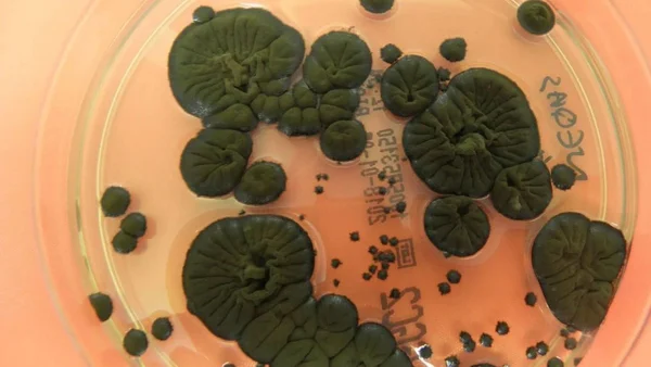 Colonies fongiques vert foncé du champignon de Tchernobyl cultivées en boîte de Petri en laboratoire.