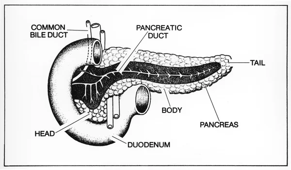 Illustration médicale montrant les détails anatomiques du pancréas, y compris la tête, le corps et la queue.
