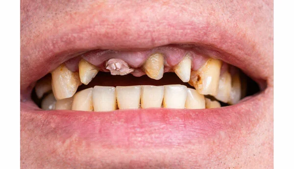 Un modèle de dent avec des tissus gingivaux dans une boîte de Pétri sur une table de laboratoire.