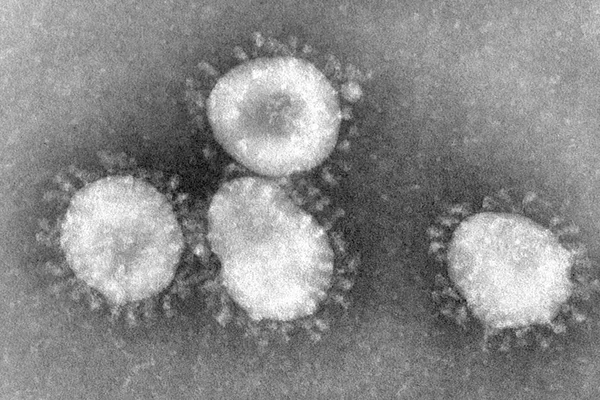 Micrographie électronique de particules de coronavirus, découvertes par June Almeida.