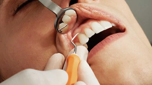 Gros plan d'une bouche montrant des dents endommagées et une excroissance gingivale.