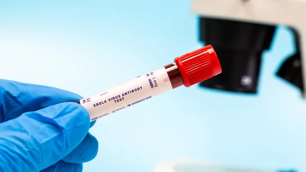 Un échantillon sanguin pour le test des anticorps du virus Ebola en laboratoire.