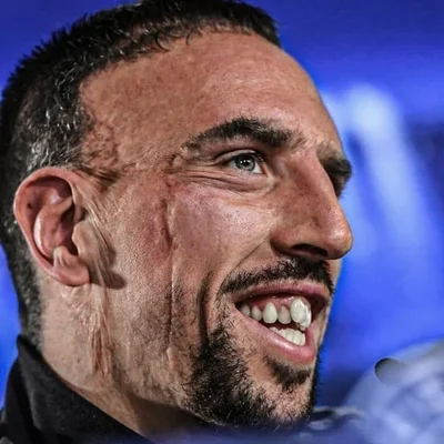 Franck Ribéry souriant.