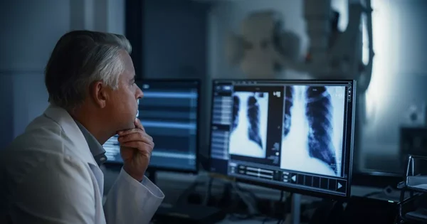 Médecin spécialiste consultant des radiographies pulmonaires sur écran.