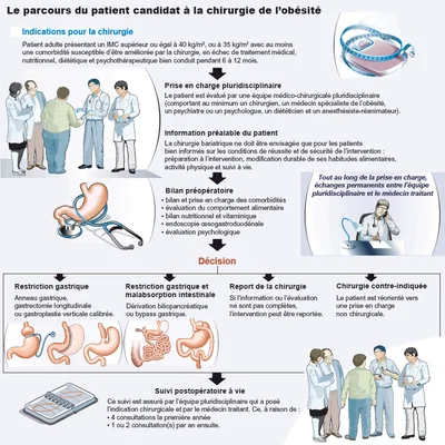 Infographie : Le traitement de l'obésité par la chirurgie | IPCO Alsace