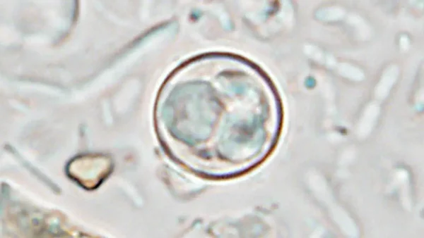 Microphotographie d'un micro-organisme suspecté dans l'épidémie de diarrhée explosive.
