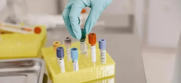 Manipulation d'échantillons en laboratoire d'analyses médicales.
