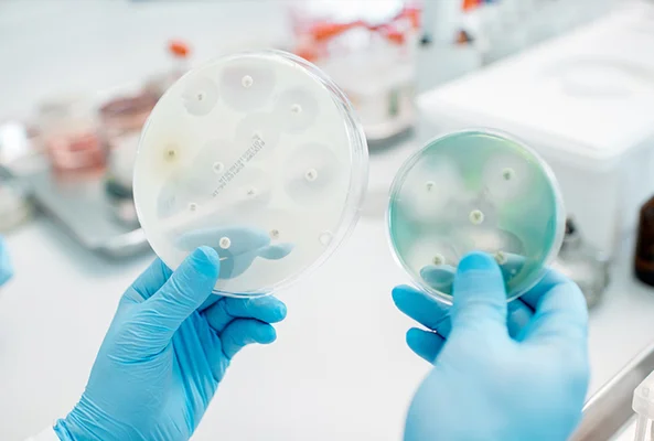 Deux mains gantées de bleu tiennent des boîtes de Petri contenant des cultures bactériennes dans un laboratoire, illustrant la résistance aux antibiotiques.