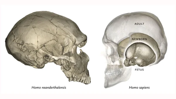 Illustration anatomique en vue latérale comparant un crâne d'Homo neanderthalensis à gauche à trois crânes d'Homo sapiens imbriqués aux stades fœtus, nouveau-né et adulte à droite, avec étiquettes