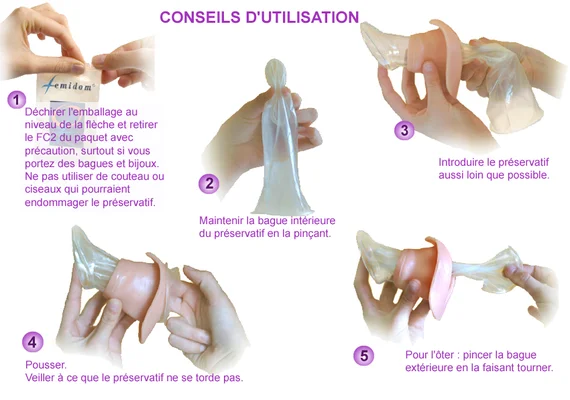 Infographie en français intitulée 'Conseils d'utilisation' présentant en cinq étapes illustrées comment insérer et utiliser le préservatif féminin Femidom So Sexy, avec des mains montrant chaque étape