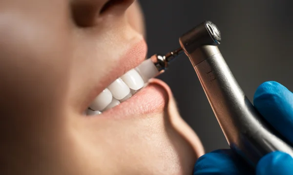 Gros plan d'une main gantée utilisant un instrument dentaire rotatif sur les dents supérieures d'un patient lors d'un détartrage en cabinet.