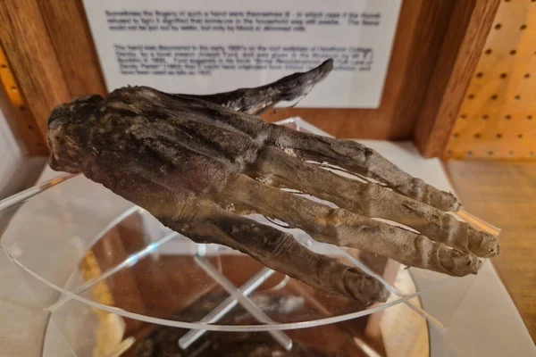Main de gloire momifiée exposée au Whitby Museum : une main humaine desséchée, aux doigts recroquevillés, fixée sur un support en acrylique transparent devant un panneau explicatif blanc, dans une vitrine en bois
