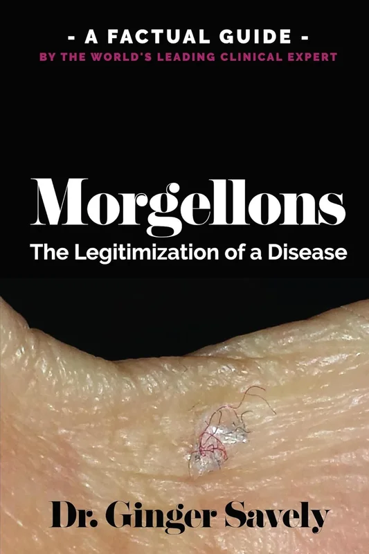 Morgellons: The legitimization of a disease: A Factual Guide by the World's Leading Clinical Expert (English Edition)      Format Kindle