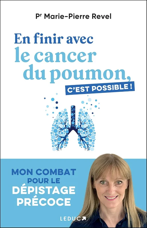 En finir avec le cancer du poumon, c'est possible !: Mon combat pour le dépistage précoce